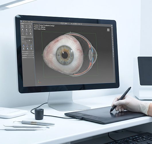 Digital 3D modeling for custom prosthetic eye design
