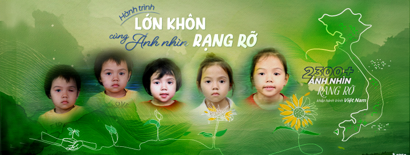 Mắt giả cá nhân 3D mang lại sự tự tin cho người bị khiếm khuyết mắt